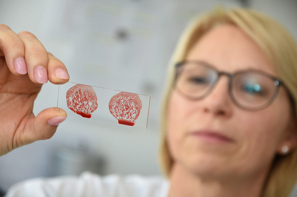 Reagenzien zur Bestimmung der Blutgruppen Die Antitoxin GmbH macht ihr Hauptgeschäft mit Reagenzien zur Bestimmung der Blutgruppen – und ist weltweit gefragt